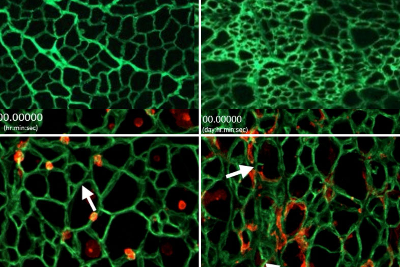 Top, left: A healthy myoscaffold. Top right: A Duchenne muscular dystrophy scaffold. Bottom left: Stem cells (red) growing in a healthy myoscaffold (green). Bottom right: Stem cells growing in a Duchenne myoscaffold (green).