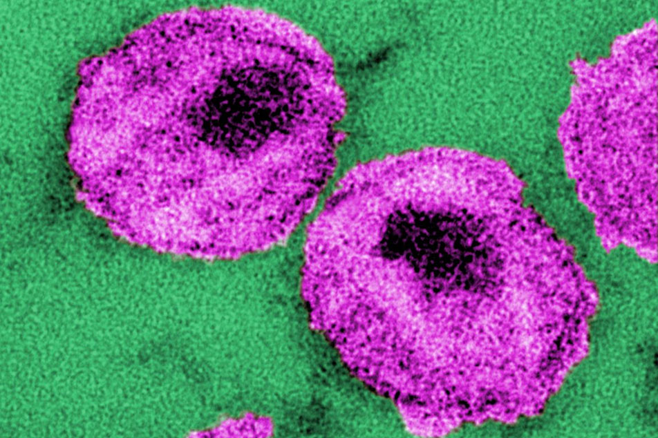 immune cells represented in pink with green background